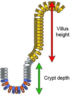 Apolipoprotein A4 Defines the Villus-Crypt Border in Duodenal Specimens for Celiac Disease Morphometry